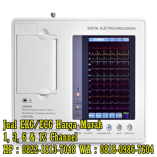 Harga ECG edan Hub WA/SMS : 0818-0986-7604.  Harga-ecg-test