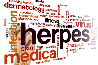What-you-need-to-know-about-herpes
