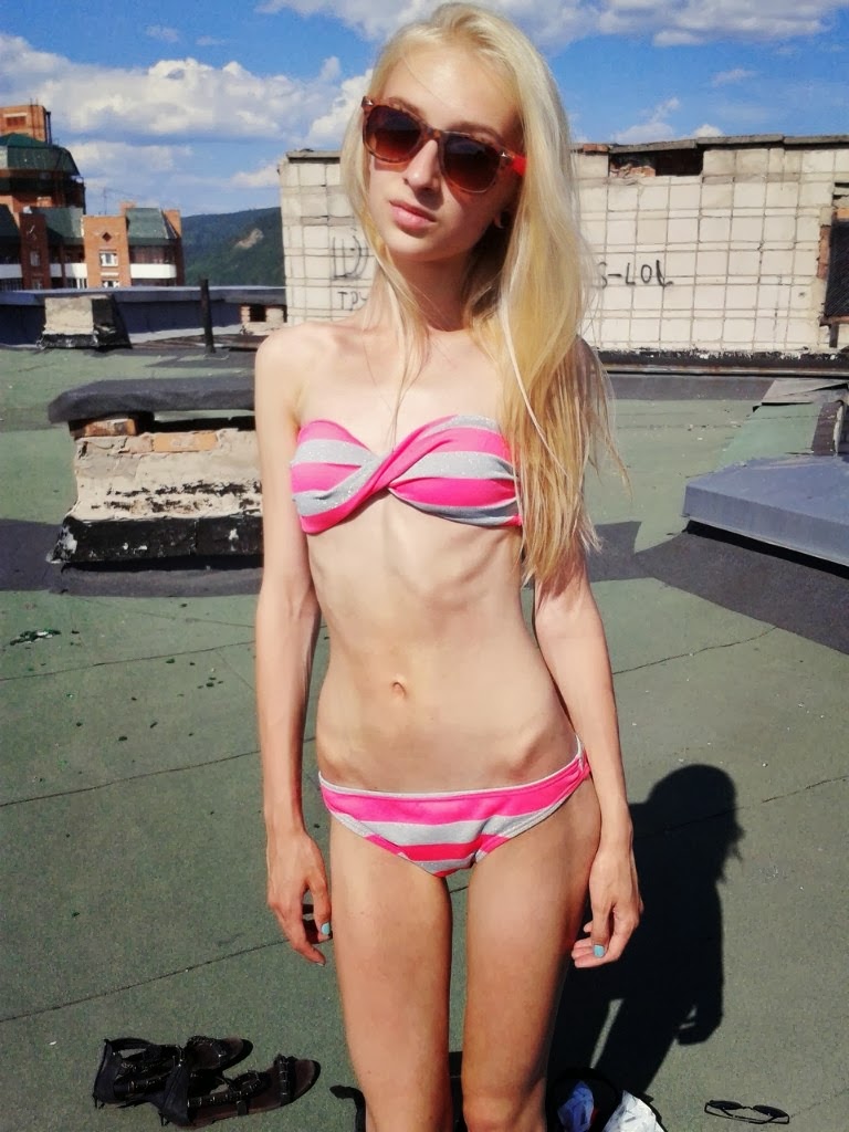 Extreme Thinspo Real Girls Real Girl Thinspiration
