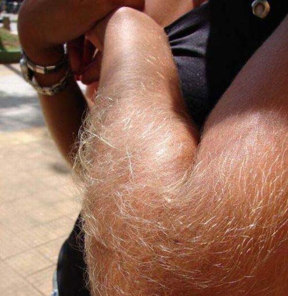 Hairy Arms 3