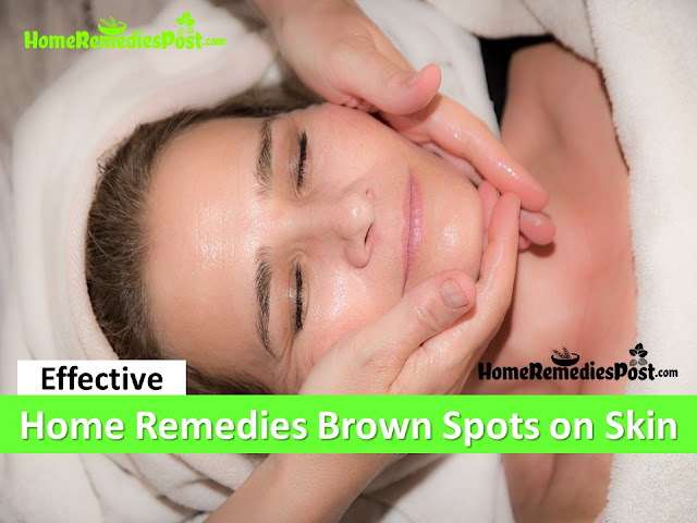 how to get rid of brown skin spots, how to get rid of dark spots fast, home remedies for brown skin spots, how to treat age spots fast, clear dark spots overnight fast, anti-aging remedies,