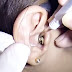 Disgusting Moment Video Shows Huge Amount Of Earwax Pulled From Woman’s Ear