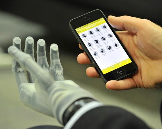 Touch Bionics i-limb Ultra Revolution, Προσθετικό χέρι με έλεγχο μέσα από application