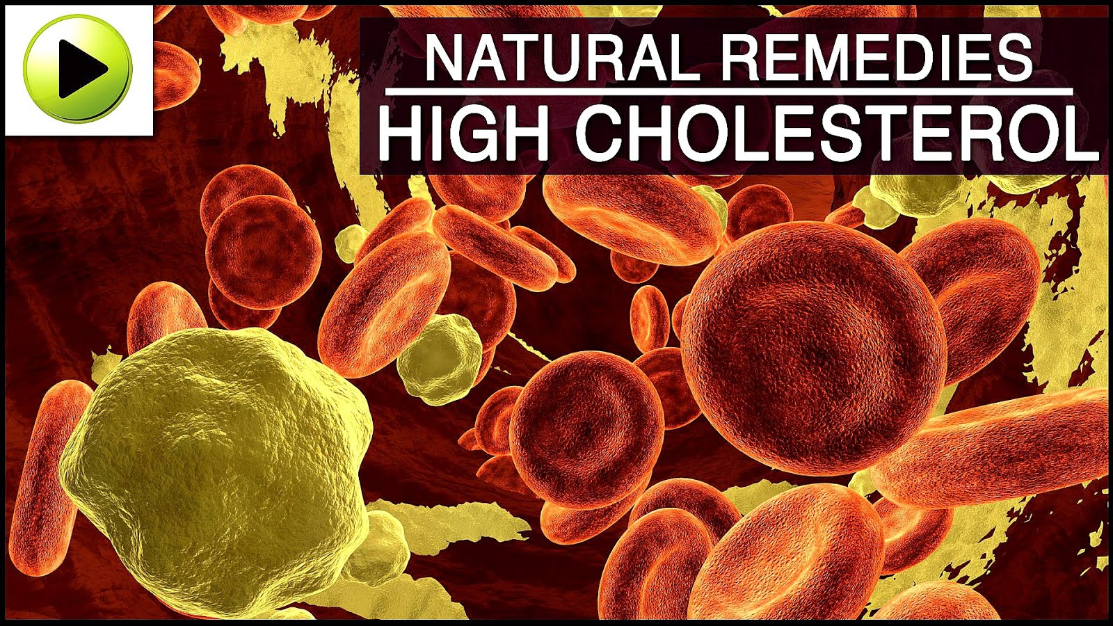 Cholesterol Colesterol Medicine Medicine Choices