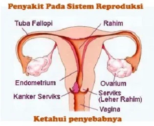 Penyakit atau Gangguan pada Sistem Reproduksi Manusia - berbagaireviews.com