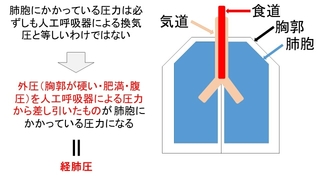 医師が食道内圧測定を行う理由
