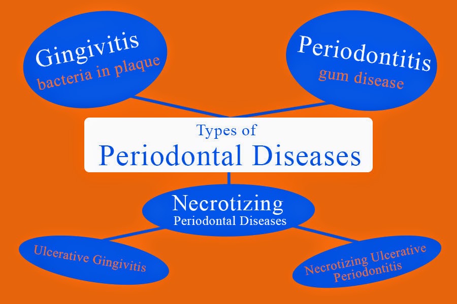 Jeffery J. Becker DDS Types of Periodontal Diseases