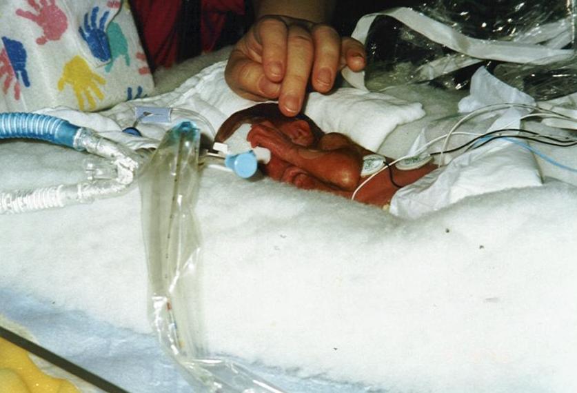 Every Day Is A Miracle My Little One Pound Six Ounce Baby My Little One Pound Six Ounce Baby Is