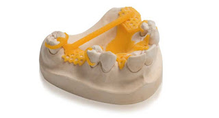 3d printing partial dentures