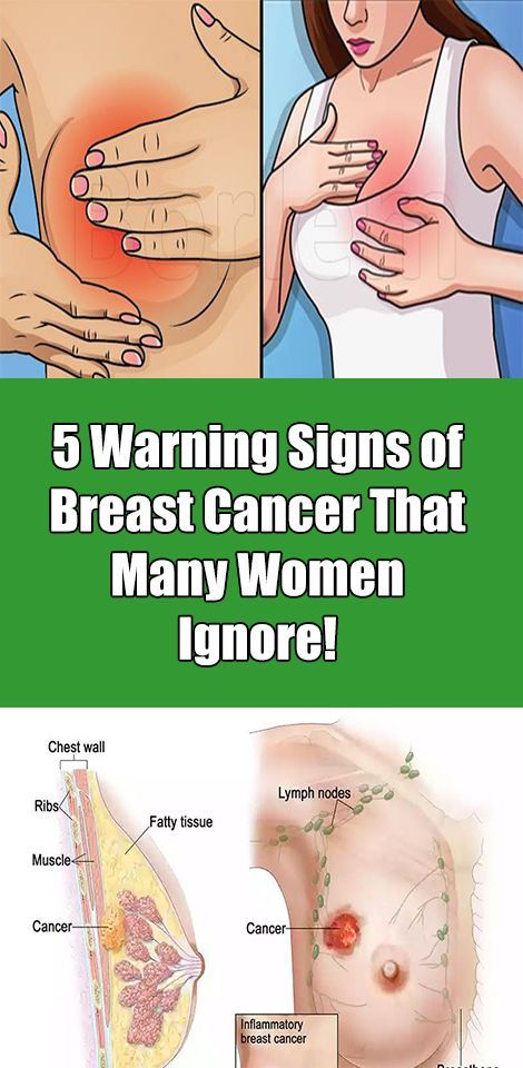 Best of Symptoms of breast cancer in women Mortal kombat sindel cosplay