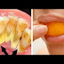 How To Easily Remove Tartar Deposits By Simply Doing This