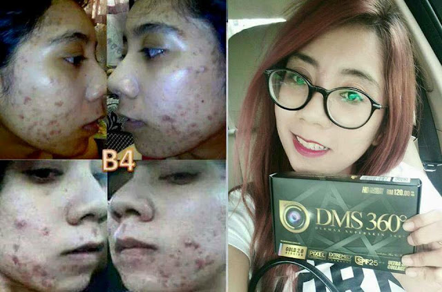 DMS 360 / 360 Cream Foundation 4D / 360 Glowing Serum / Glutax Dermax Superskin