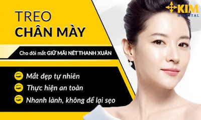 Treo chân mày bằng chỉ