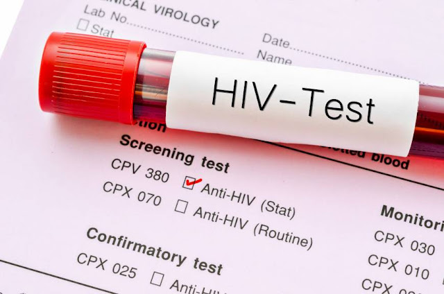 Jangan Abaikan, Ini 5 Tanda Gejala HIV & AIDS yang Bisa Saja Mengintaimu Jangan Abaikan, Ini 5 Tanda Gejala HIV & AIDS yang Bisa Saja Mengintaimu