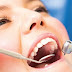Điều trị sâu răng sau khi niềng răng