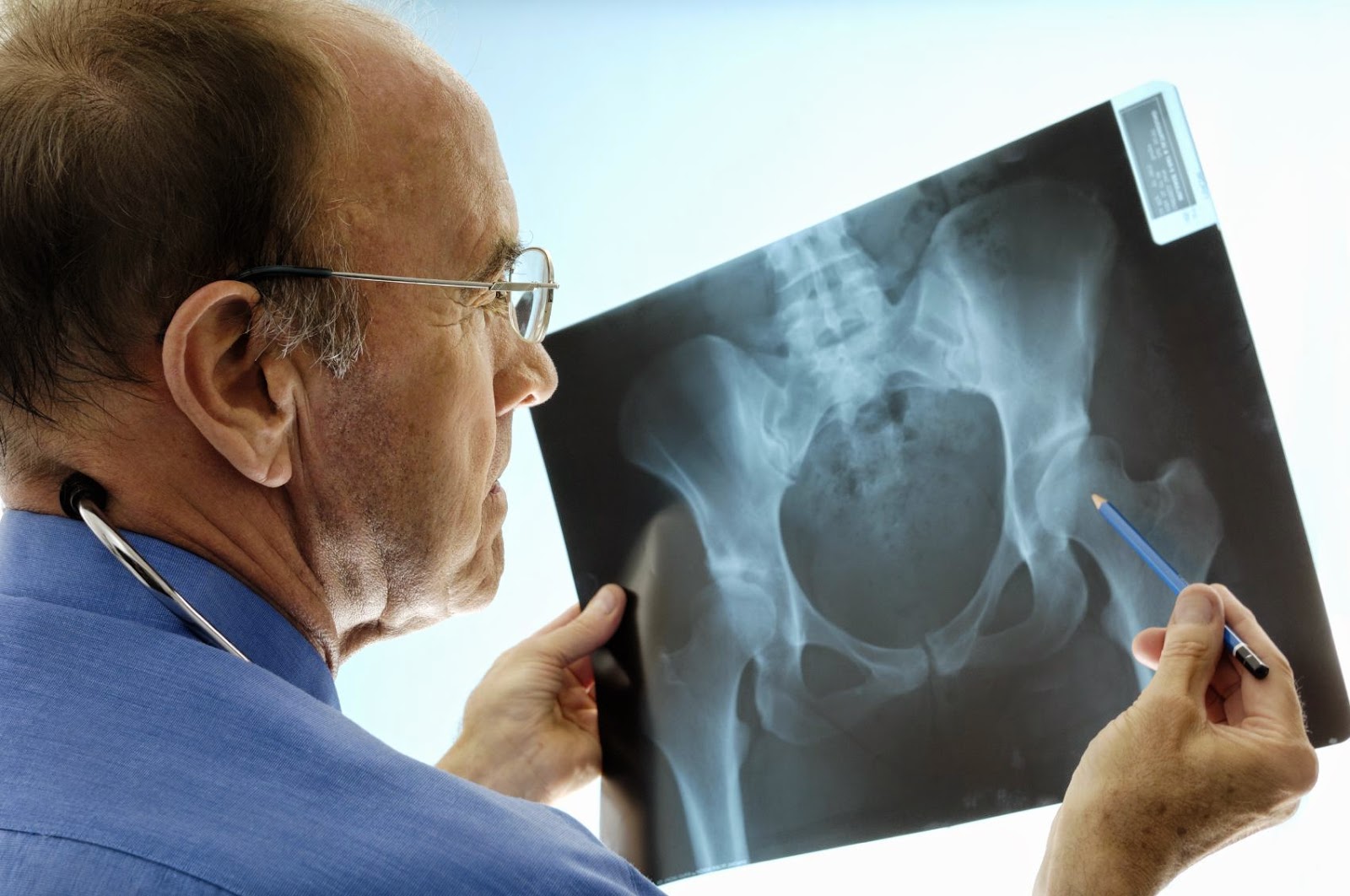 Pruebas y Exámenes comprobar osteoporosis