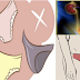 5 Things That Happen To Your Body if You Don't Change Your Underwear