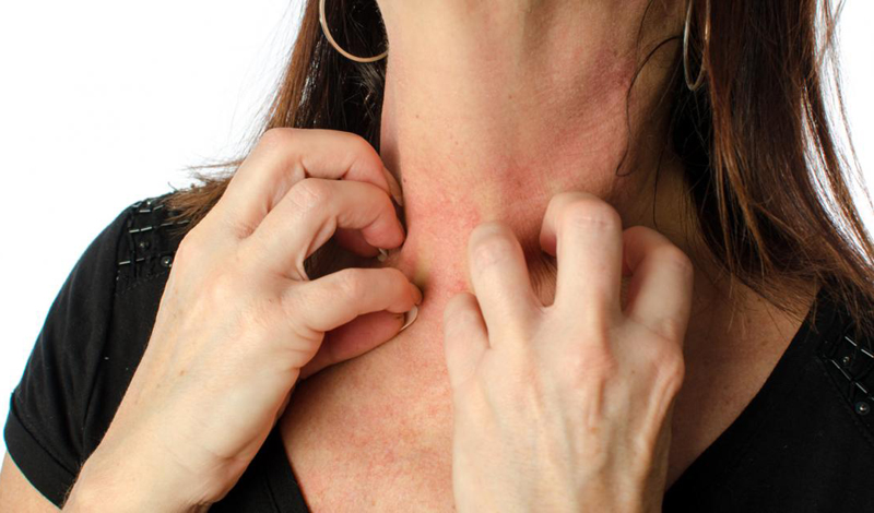 Stress Rashes 11 Ways Your Body Is Telling You You're Too Stressed