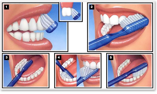 Comment Faire Le Floss