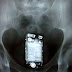SE DEU MAL:Detendo esconde celular no ânus durante revista em cela, mas o telefone tocou