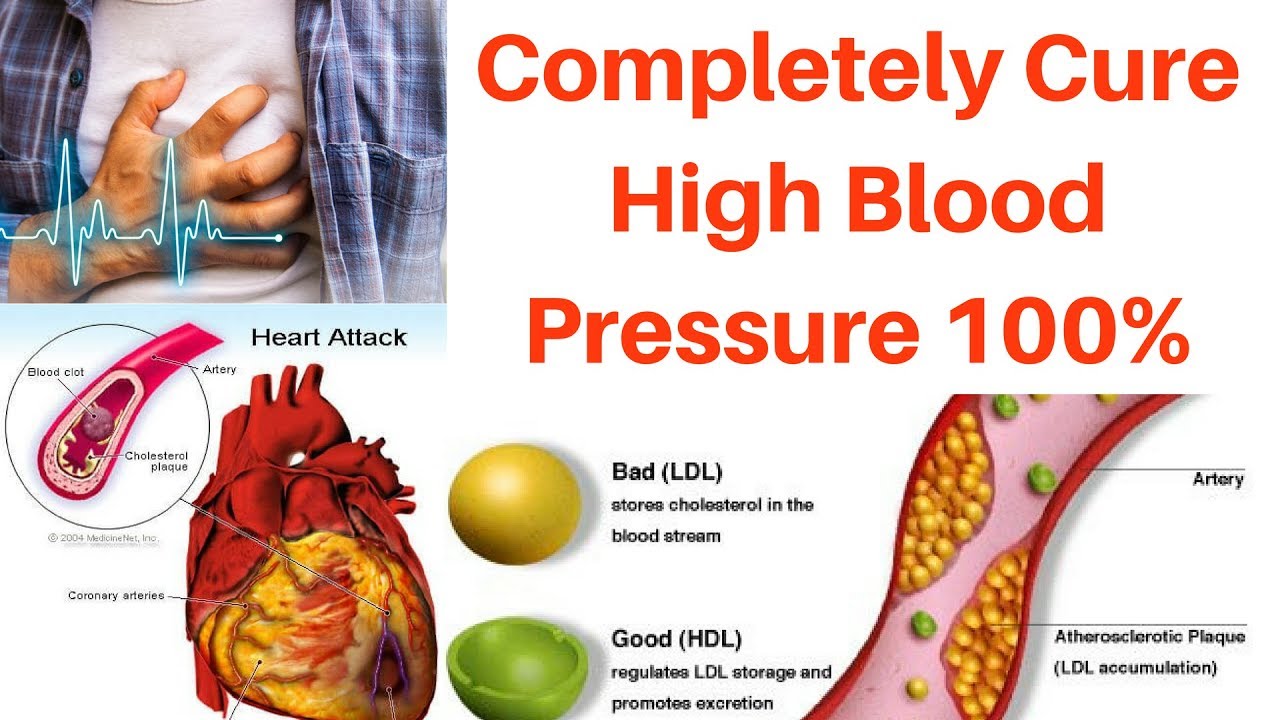 ARE YOU SUFFERING FROM BP? CLICK HERE FOR SOLUTION