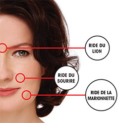 Les rides « simples » Les-rides-simples