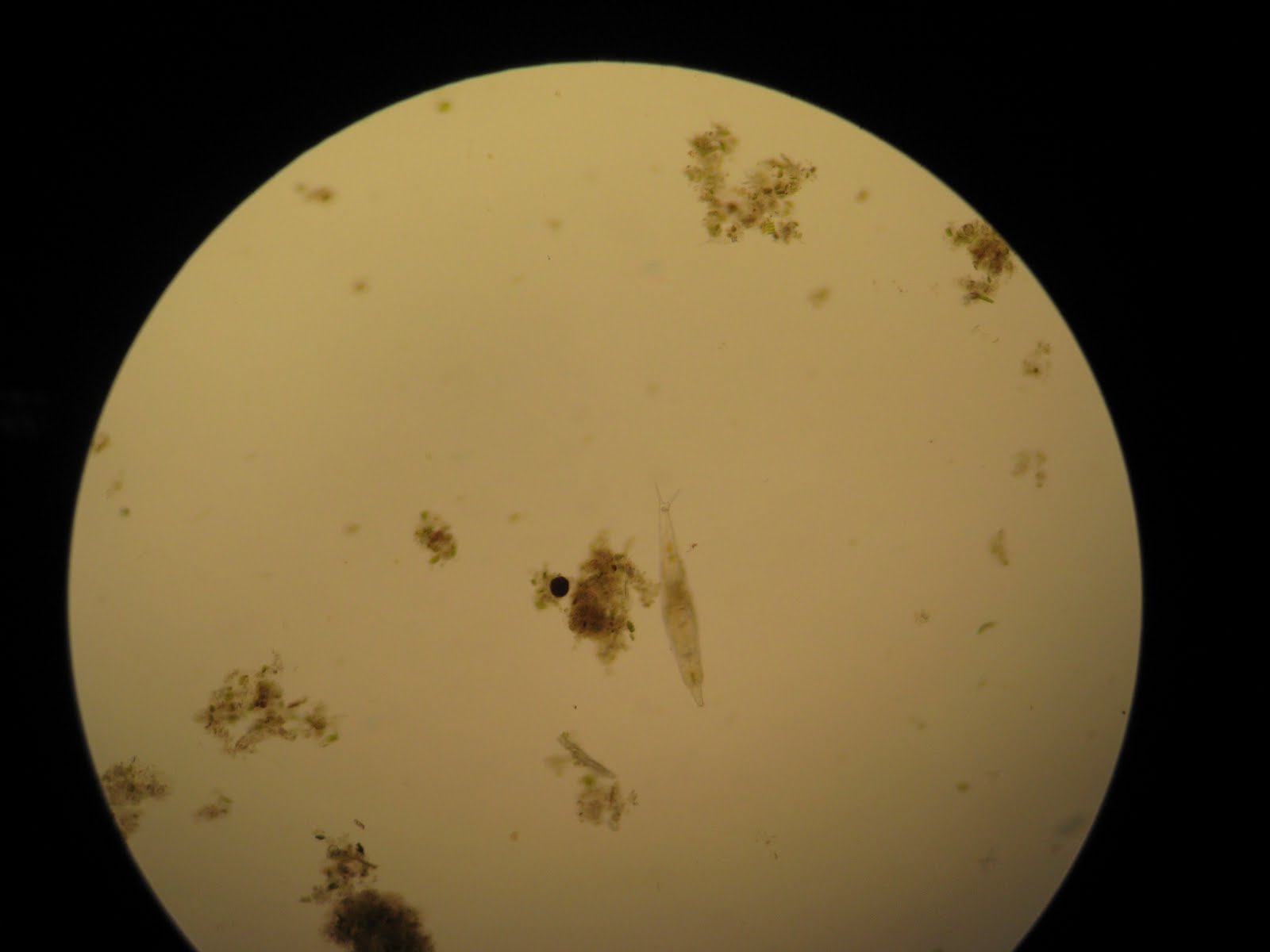 Microbiology Of Pond Water Lab Report