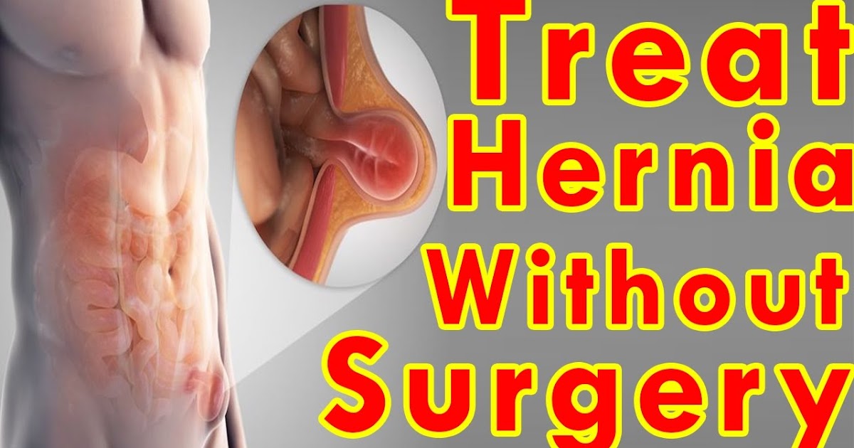 5 Ways To Treat Hernia