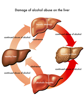 अल्कोहल के प्रभाव, शराब पीने के फायदे और नुकसान, शराब के दुष्परिणाम, शराब के नाम, शराब के प्रकार, शराब से होने वाले नुकसान, शराब से होने वाले रोग, रम शराब, शराब छुड़ाने के उपाय