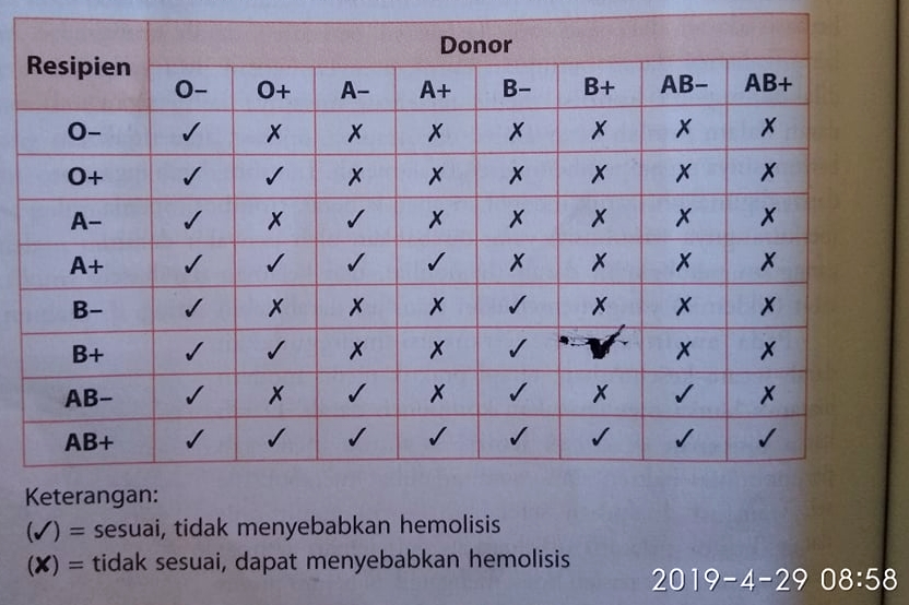 Lengkapi tabel kesesuaian transfusi darah berdasarkan sistem ABO dan