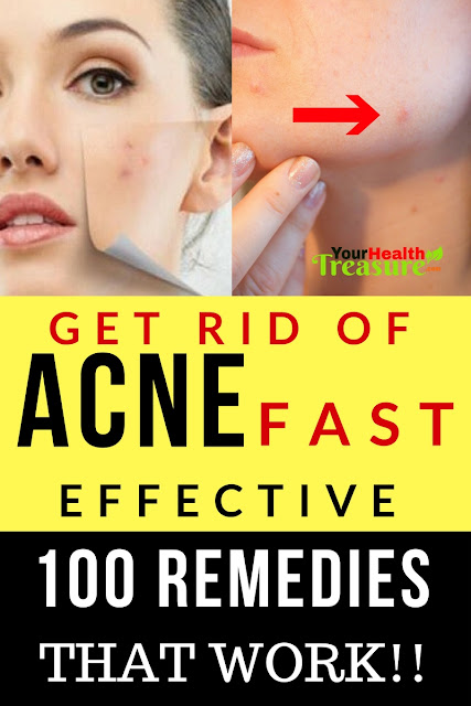 How To Get Really Clear Skin Naturally How To Get Really Clear Skin Naturally
