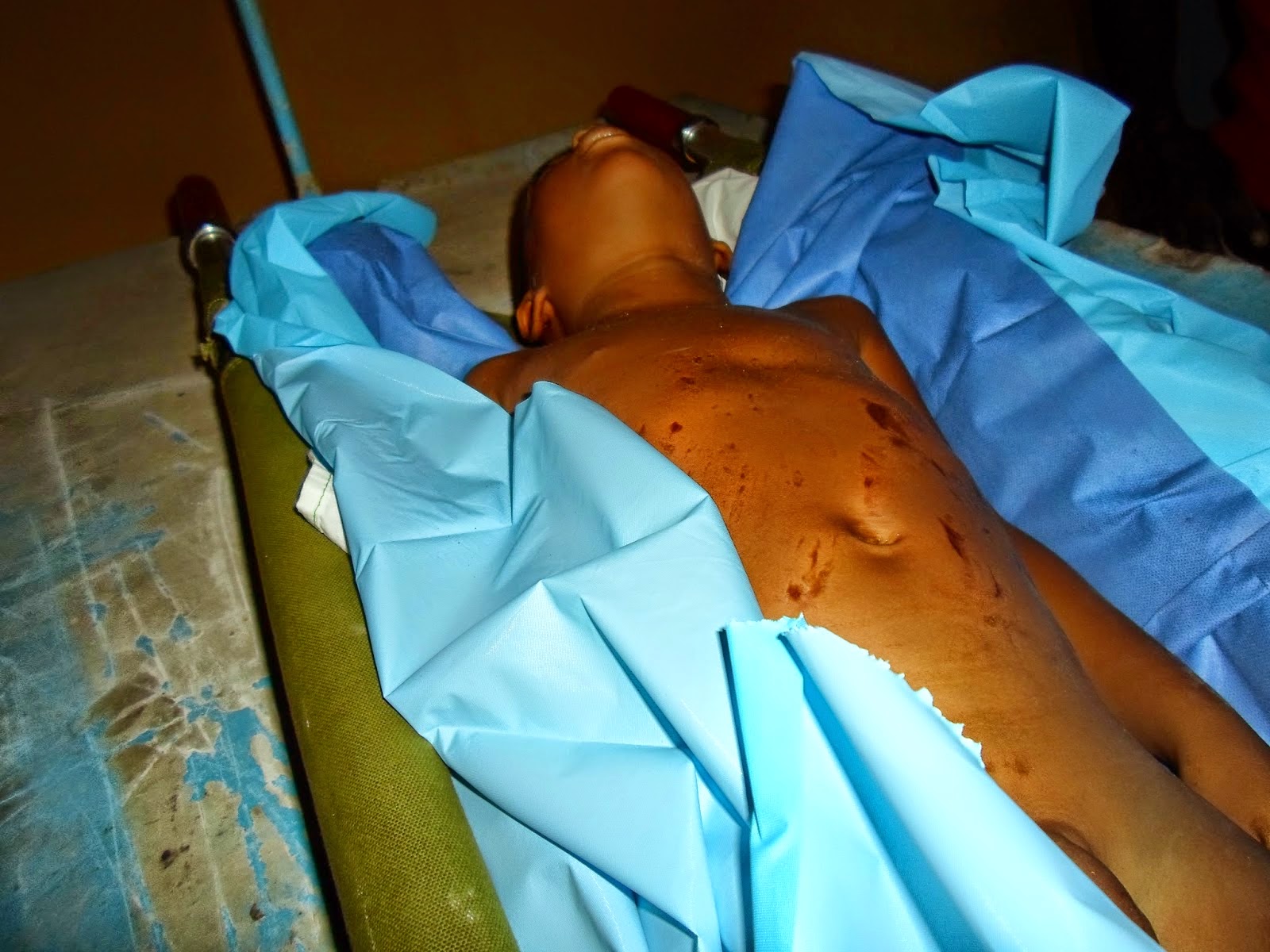   Menor de edad pierde la vida al chocar posala  con un camión en crece Cabral , Barahona 