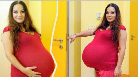 Hoax Atau Fakta? Wanita ini hamil selama 23 bulan, dan Saat Melahirkan bayinya berbobot 8.6 Kg
