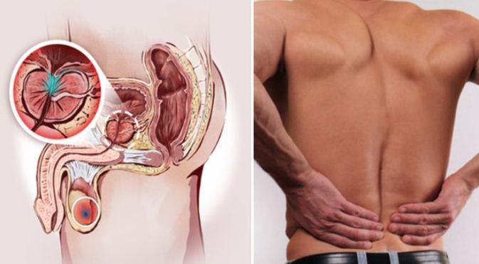 simptomele prostatitei la vârstnici tratamentul prostatitei în coreea de sud