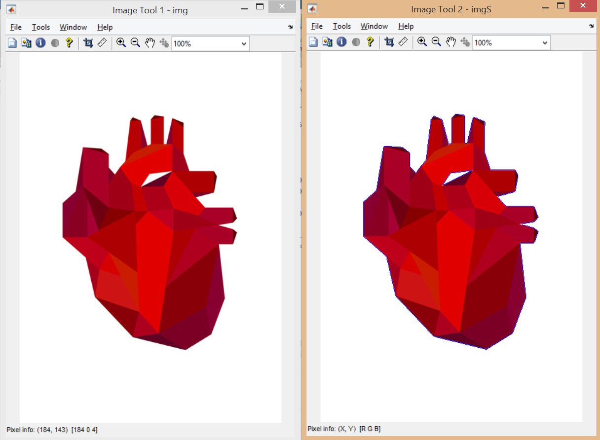 Ahmet Öztürk Mechatronics: Matlab Image Processing: Edge Detection Sample