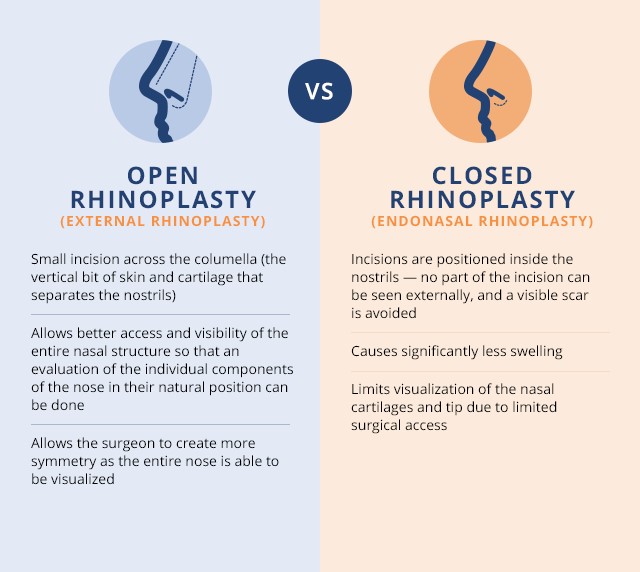 rhinoplasty singapore reviews and prices