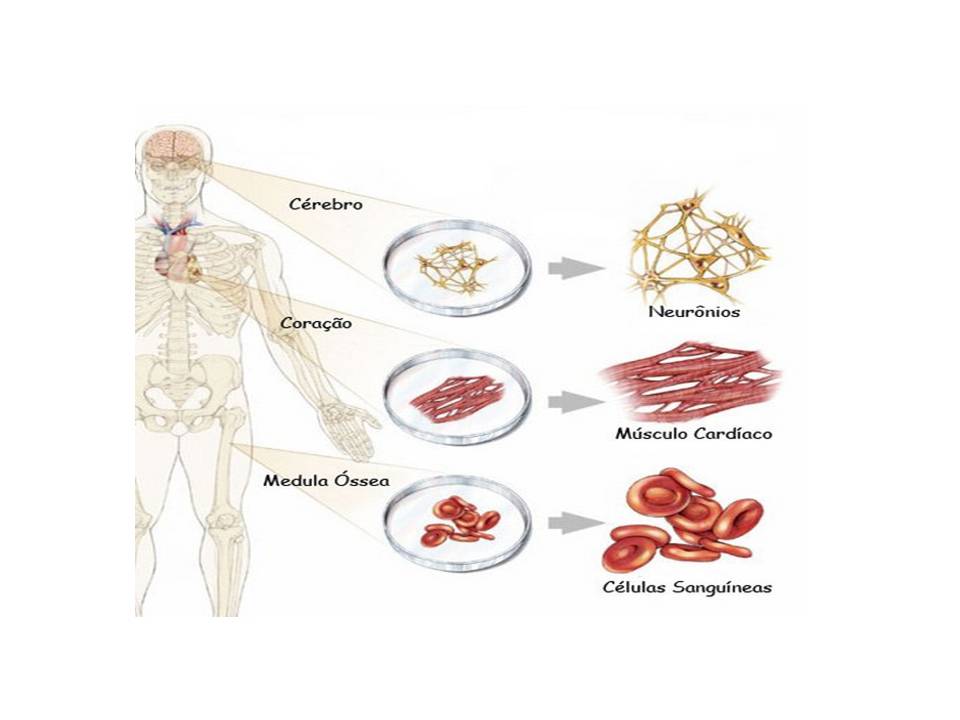 Células Da Medula Óssea São Exemplos De Células-Tronco Pluripotentes