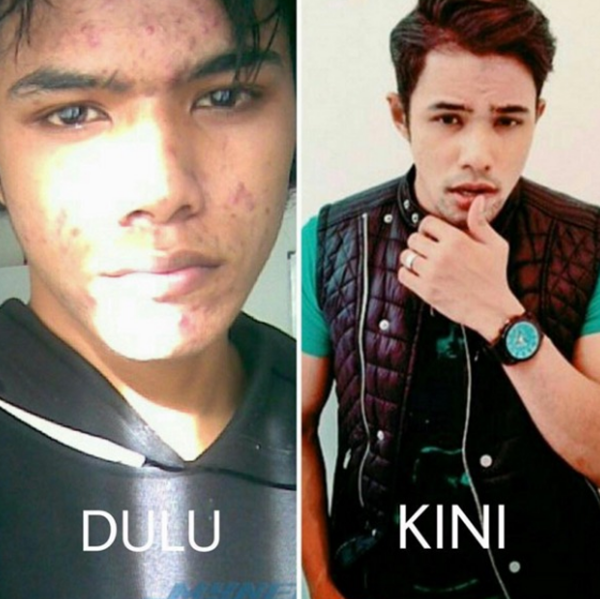 PASTI ANDA TAK PERCAYA! Inilah Perbandingan Wajah Artis Dahulu Dan Terkini Bikin Anda TERNGANGA PASTI ANDA TAK PERCAYA! Inilah Perbandingan Wajah Artis Dahulu Dan Terkini Bikin Anda TERNGANGA
