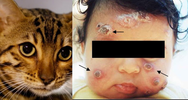 Epidemia de esporotricose no estado assusta moradores da Baixada