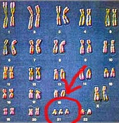 penambahan kromosom