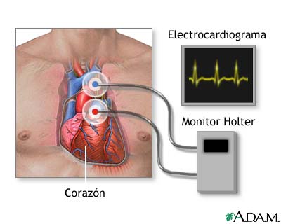 eretismo cardiaco