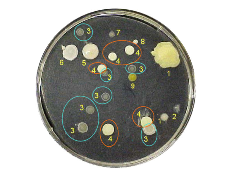 Medical Laboratory and Biomedical Science Interpreting Plates Colony