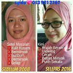 Syahida Ali | Pengedar Shaklee | Kedai Vitamin Puchong