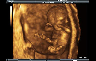 13 haftalık gebelik görüntüsü