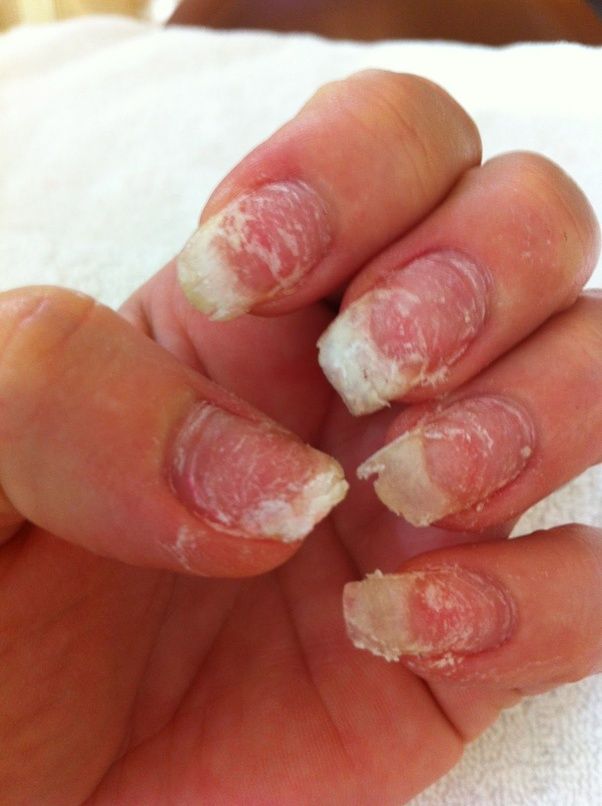 Do You Go To A Dangerous Salon Pepper And Prada Plastic And These Salons Are Using That Kind Of Strength On Your Natural Nails Oo My Ruined From Acrylics Yes S They