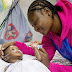  Conjoined Twins Separated Successfully