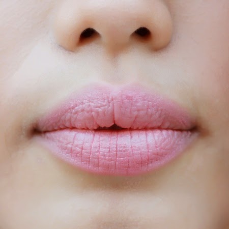 Cara Mudah Atasi bibir PecahPecah Secara Alami