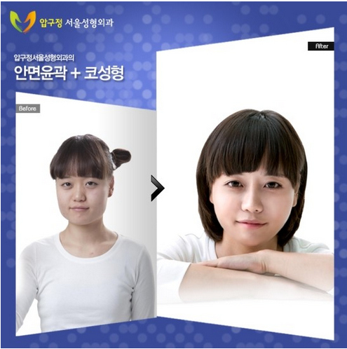 cosmetic plastic  Surgery results
