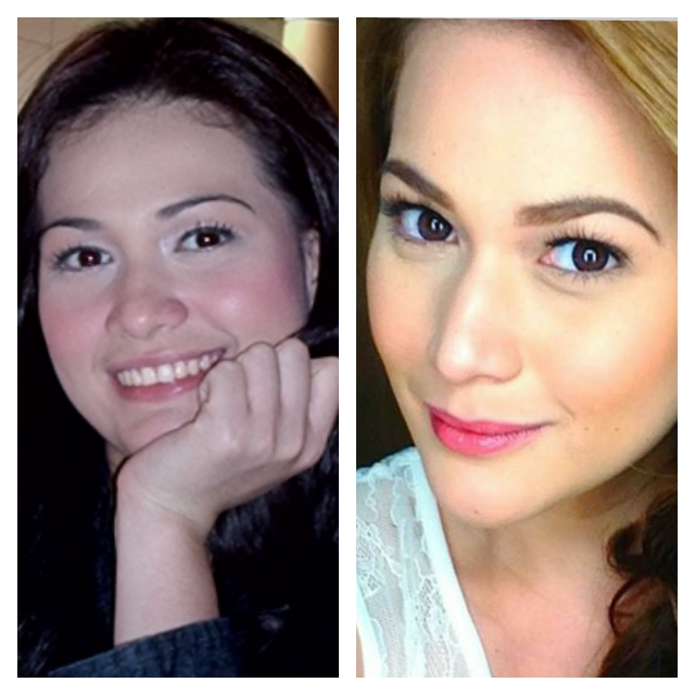 Angel locsin before and after