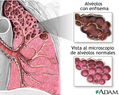 Alveolos 1-2